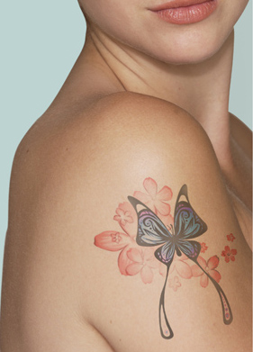 Tattoo Removal Kochi | Permanent Tattoo Removal Treatments