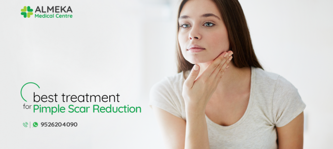 What is the best treatment for Pimple Scar Reduction?