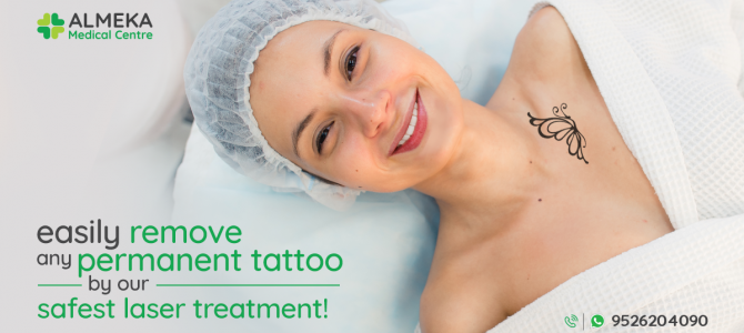 Easily remove any permanent tattoo by our safest laser treatment!