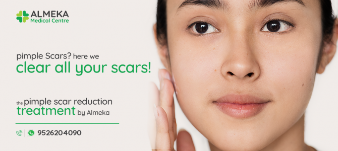 Pimple Scars? Dead Skin? Here we clear all your scars!