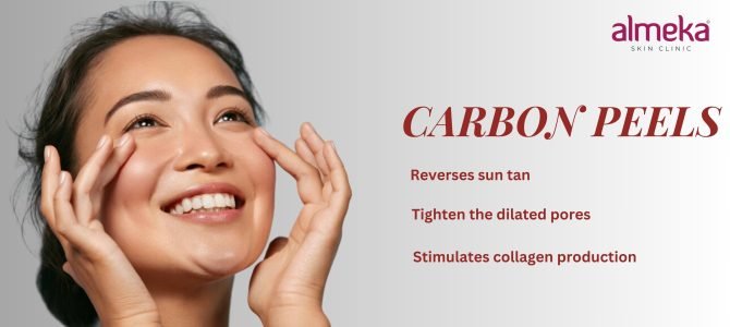 Carbon Peel: Your Path to Youthful Glow