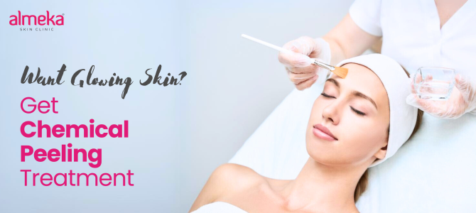 <strong>Transform Your Skin with Chemical Peel Treatment</strong>