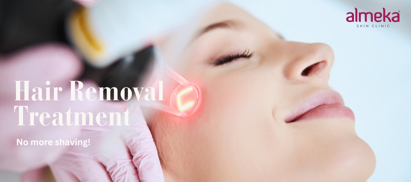 Exploring the Benefits of Laser Hair Removal in Kochi